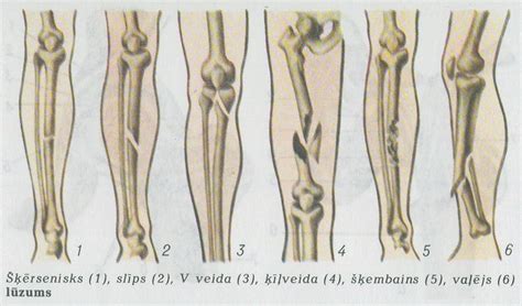 neslimo.lv